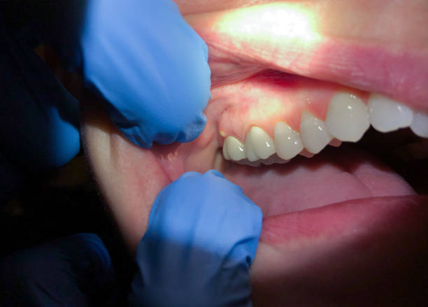 Emergency Dentist Open Today in NJ